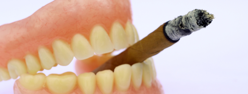 cigar and brown teeth, tobacco use on oral health