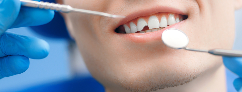 man with broken tooth, emergency dental care