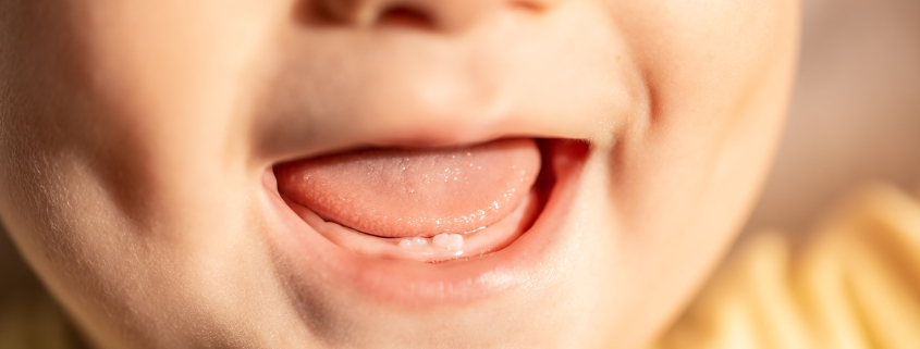 baby smiling with first teeth