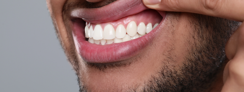 man showing off healthy gums
