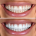 white and yellow teeth comparison