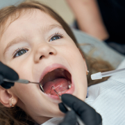 early dental visits for children