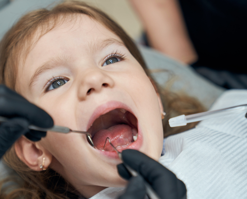 early dental visits for children