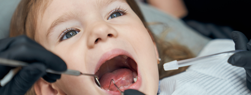 early dental visits for children